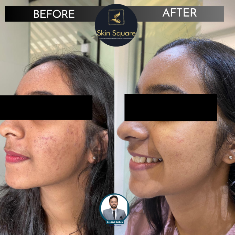 Skin Square Post (6)