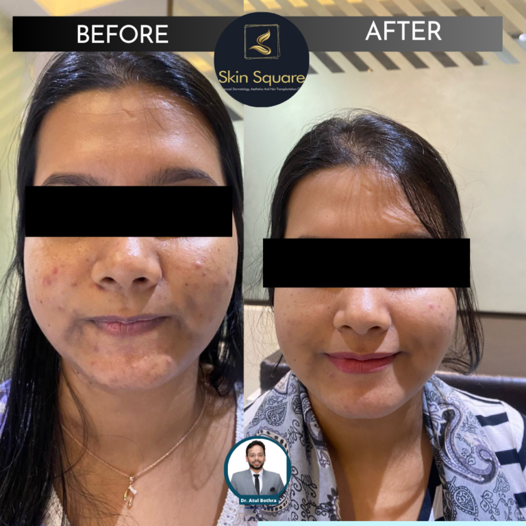 Skin Square Post (7)