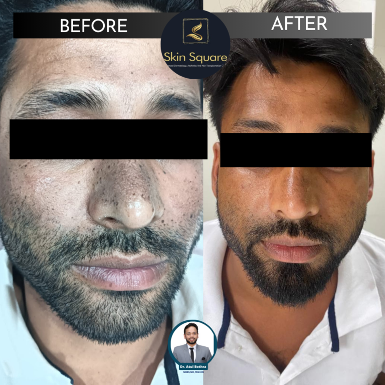 Skin Square Post (8)