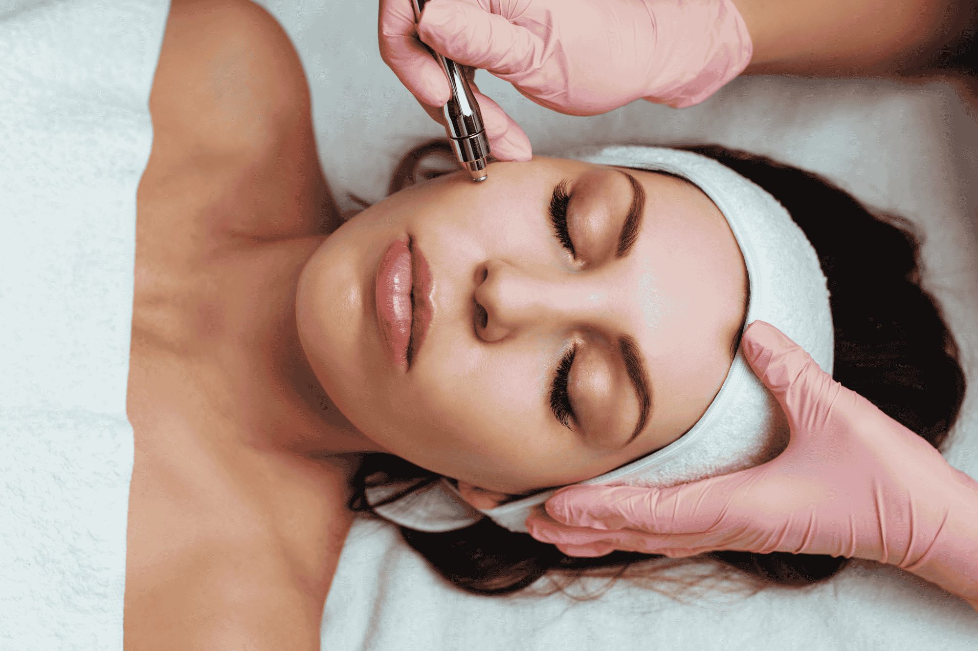DERMAPLANING